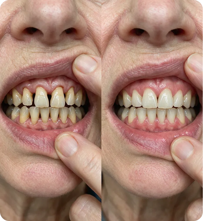 Carol W. before and after
