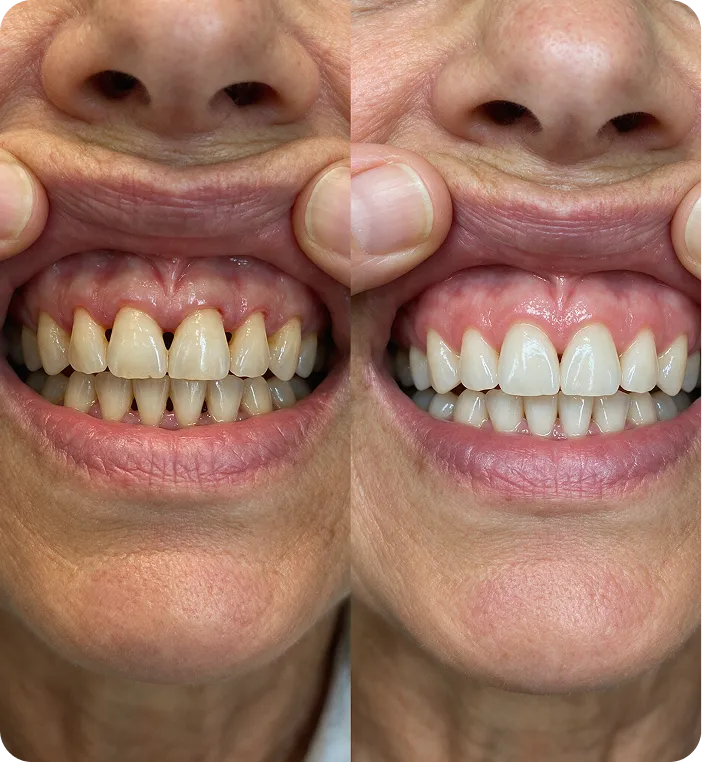 Lutisha R. before and after