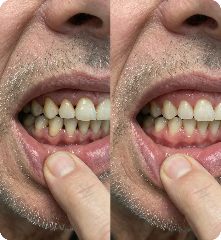 Daniel G. before and after