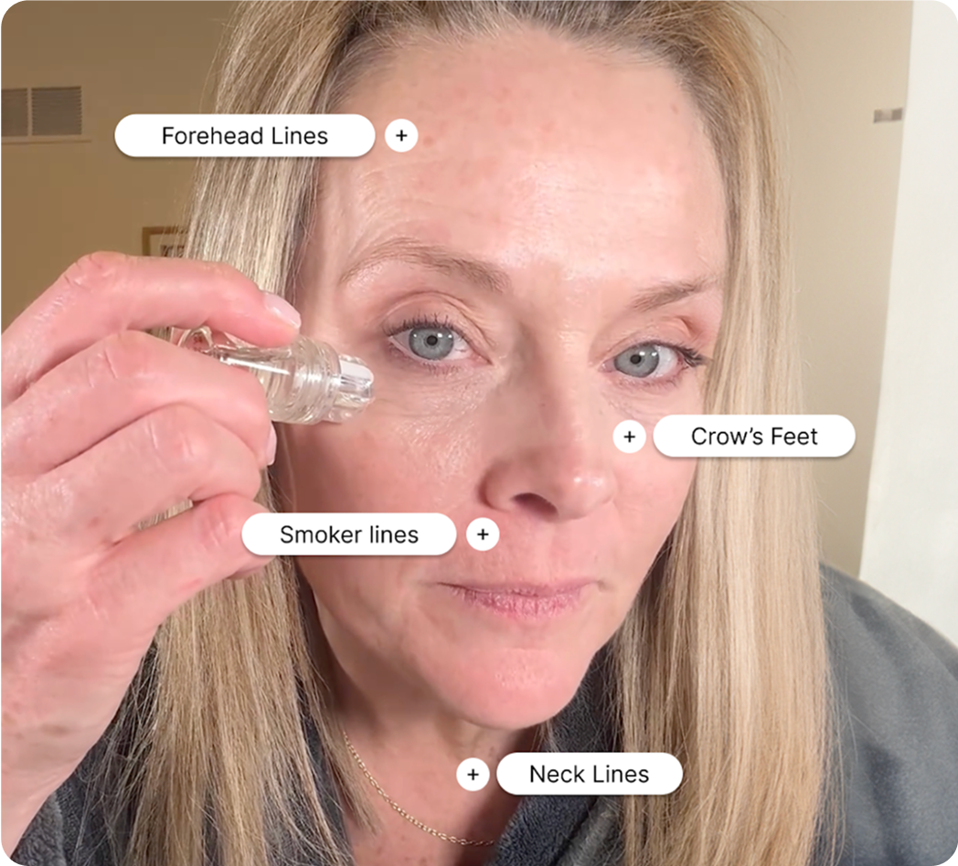 Micro Infusion Device Being Used