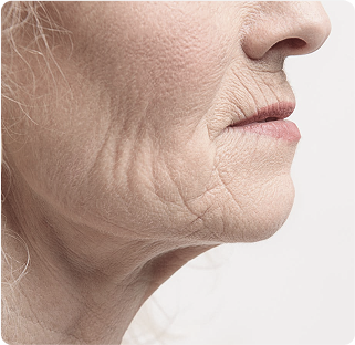 Deep Wrinkles