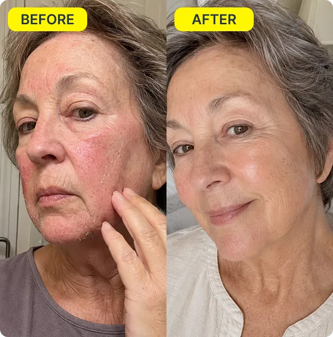 Martha before and after Spotlight Mist