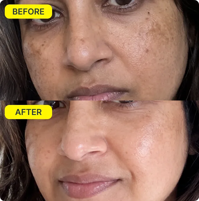 Priya before and after Spotlight Mist