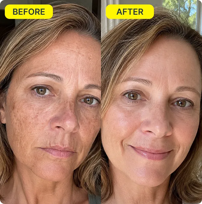 Elena before and after Spotlight Mist
