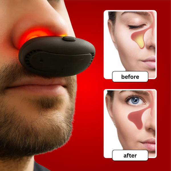 SinusGuard Red Light Therapy Device