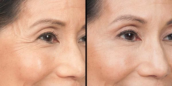 1676788545 5f3095e14e269479a8d8e33a V s46Q1qrl1y sV3Dol2ZYuoldtYwzHqOfj GZUAf6t3iny