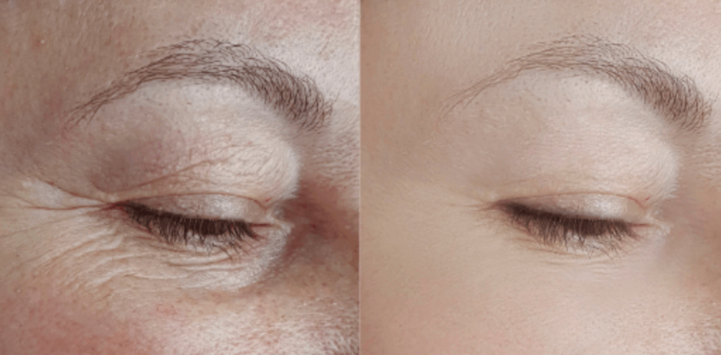 1719658001 Bildschirmfoto 2024 06 29 um 12.46.29