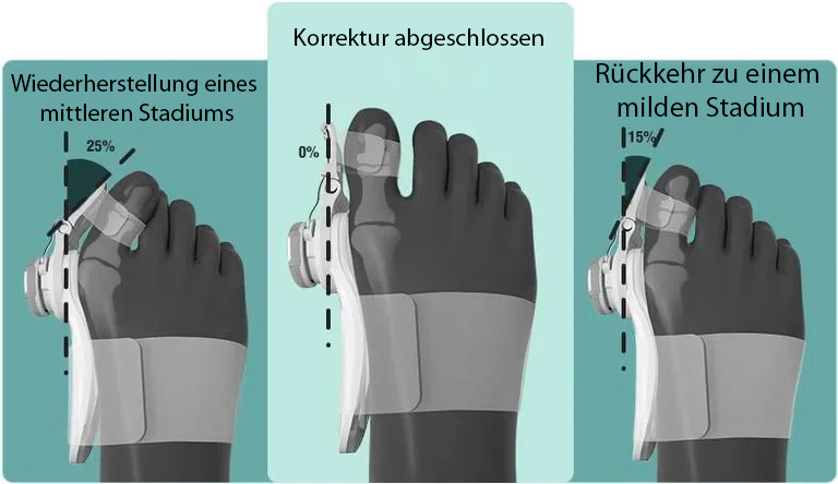 KnieFlex Therapiegerät in der Anwendung