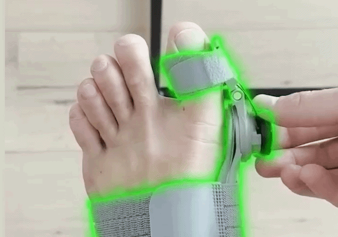 Innovative Technologie zur Knieschmerzbehandlung