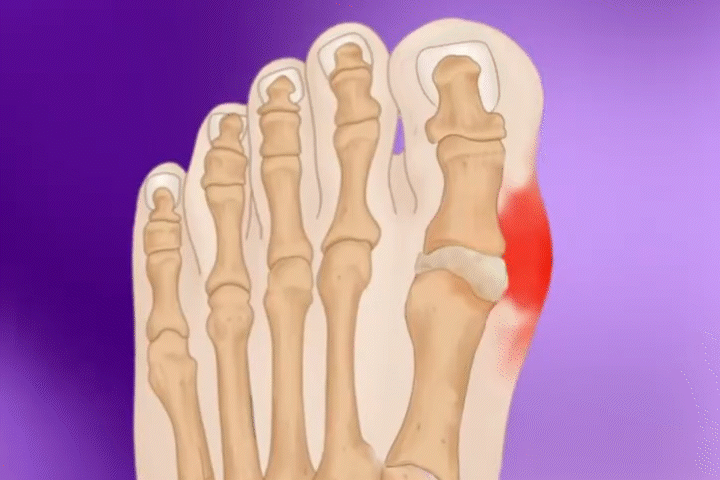 Innovative Technologie zur Knieschmerzbehandlung