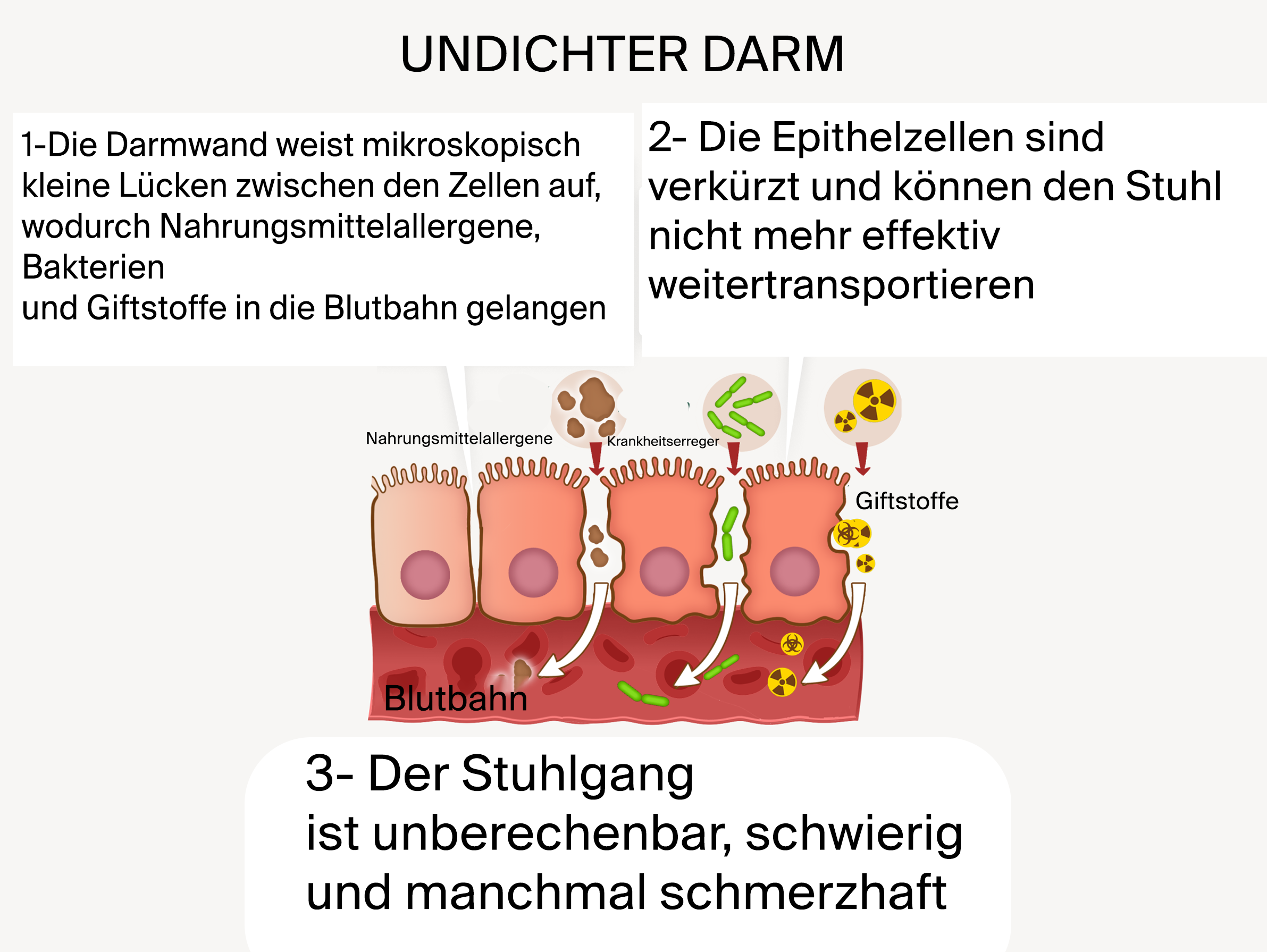 Healthy vs Leaky Gut Diagram