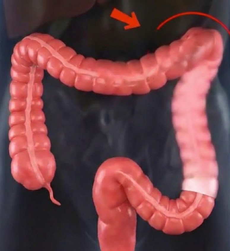 Innovative Technologie zur Knieschmerzbehandlung