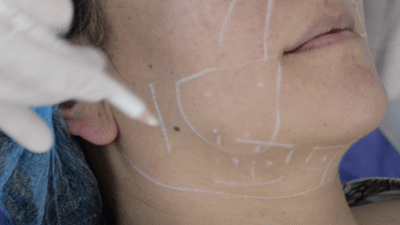 Innovative Technologie zur Knieschmerzbehandlung