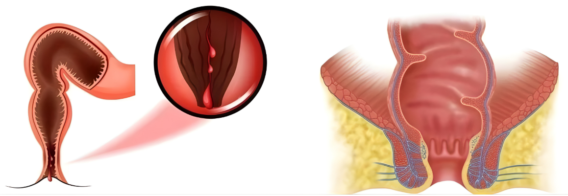 Innovative Technologie zur Knieschmerzbehandlung
