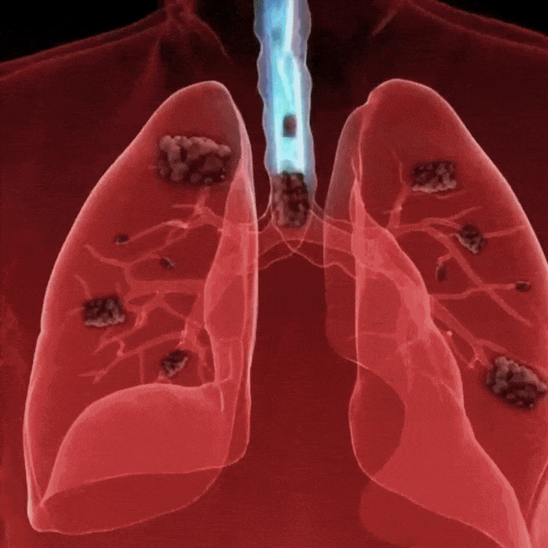 Respiratory Therapist