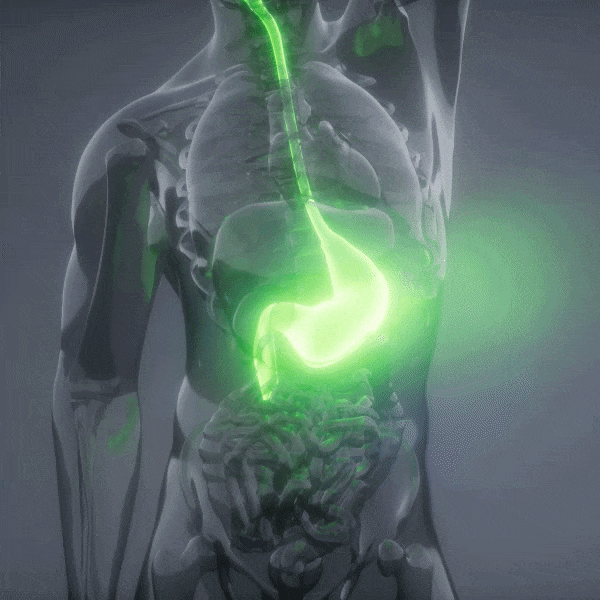 Woman with hair loss