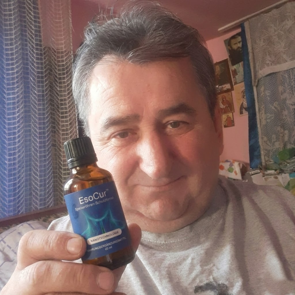 Woman with hair loss