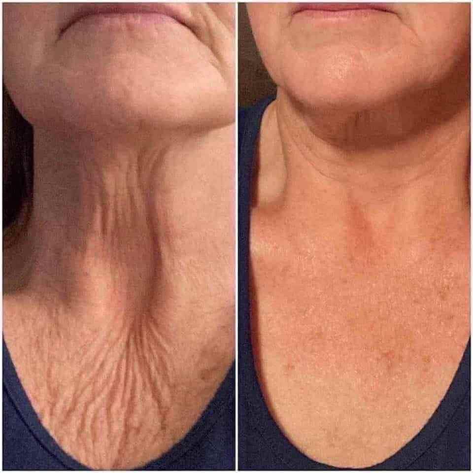 Woman with hair loss