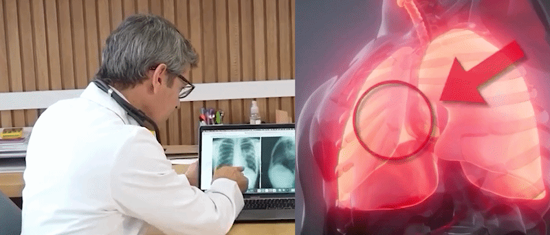 Innovative Technologie zur Knieschmerzbehandlung