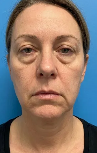 Week 1 customer result