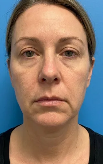 Week 2 customer result