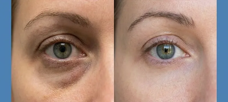 Arm Toning Solutions