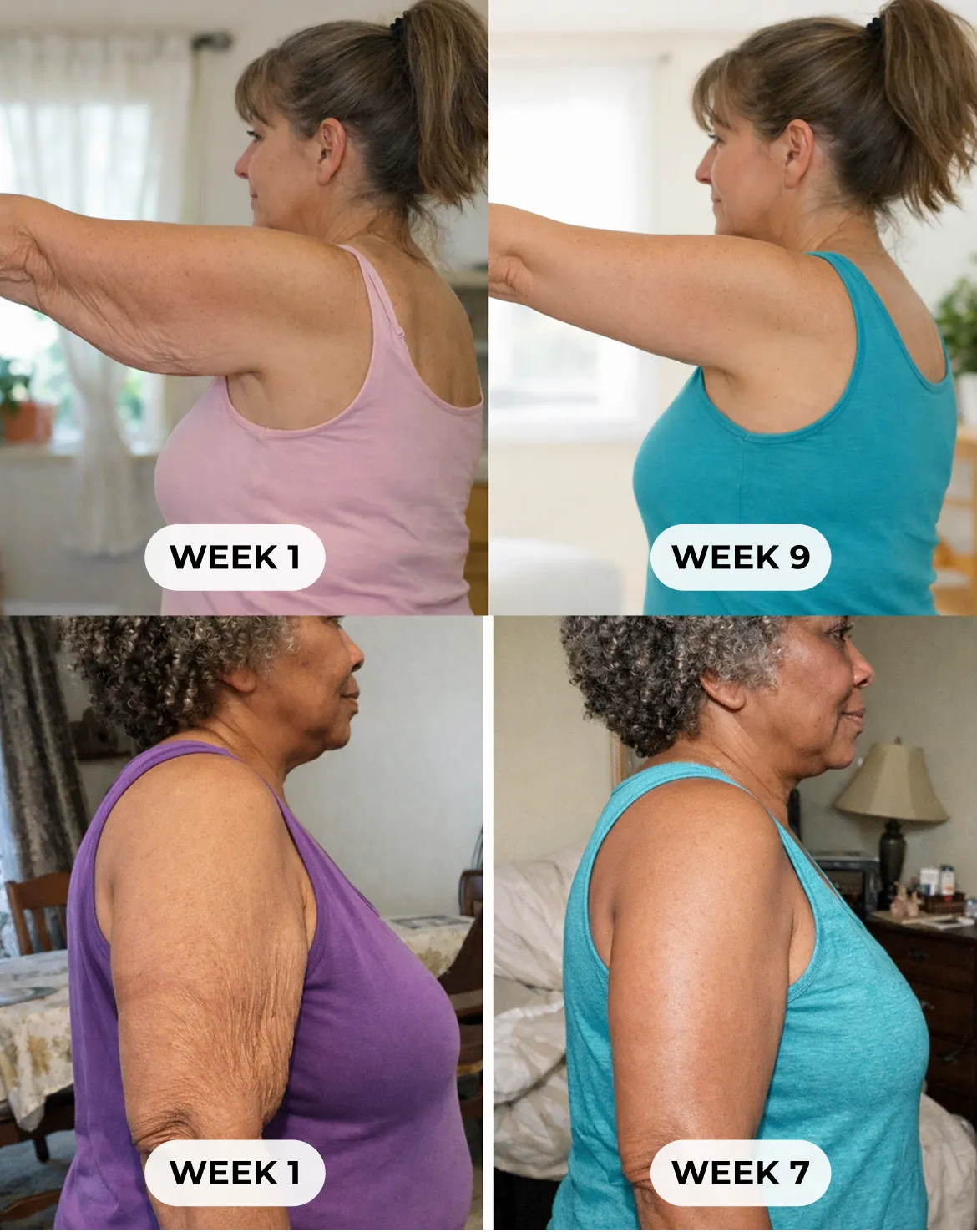 Arm Toning Solutions