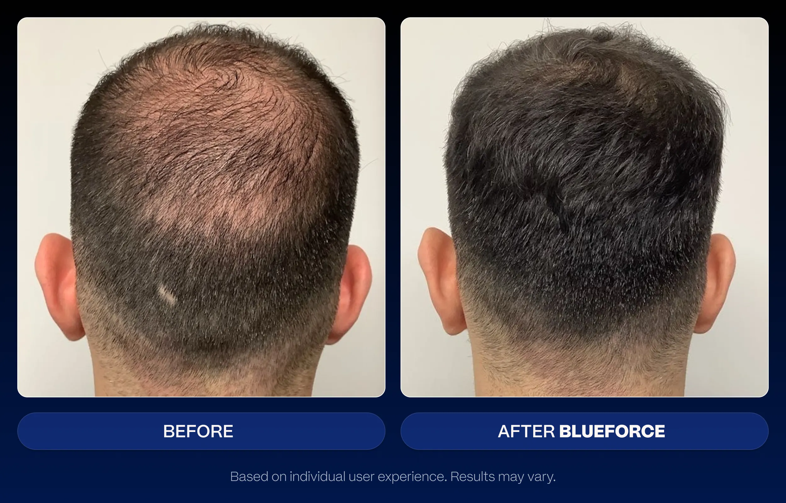 Follifusion results