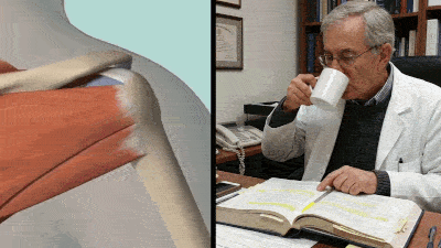 Crossed-out pills, cortisone shot, and failed shoulder treatments